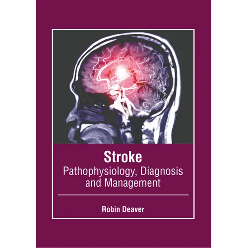 Stroke: Pathophysiology, Diagnosis and Management - Hardcover