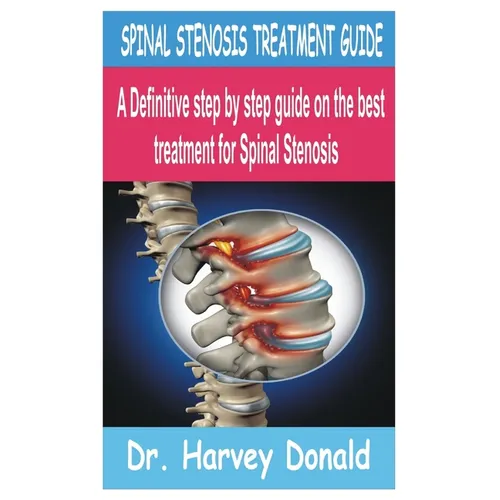 Spinal Stenosis Treatment Guide: A Definitive step by step guide on the best treatment for Spinal Stenosis - Paperback