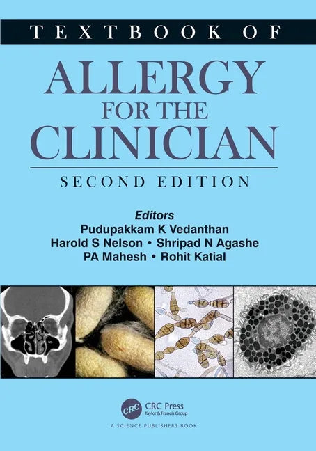 Textbook of Allergy for the Clinician - Paperback