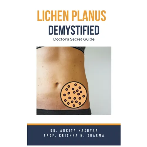 Lichen Planus Demystified Doctors Secret Guide - Paperback
