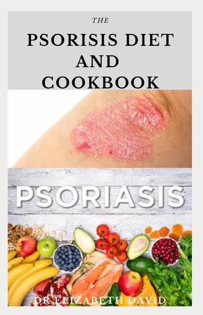 The Psoriasis Diet and Cookbook: Dietary Guide For Preventing and Healing Psoriasis: Includes Delicious Recipe, Meal Plan and Cookbook - Paperback