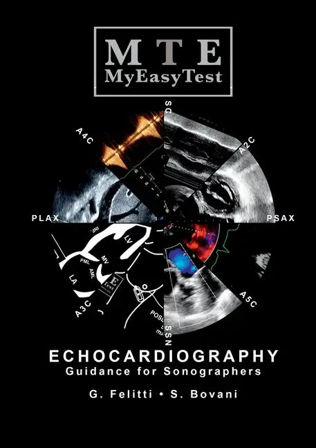 Echocardiography - MyEasyTest - Paperback
