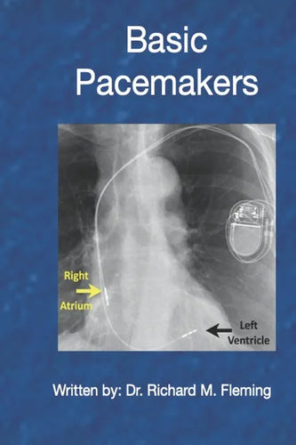 Basic Pacemakers - Paperback