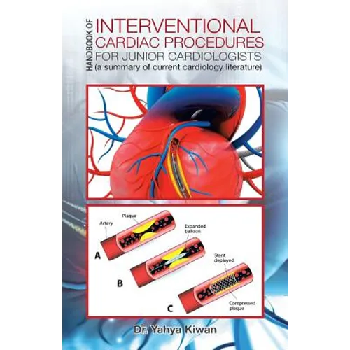Handbook of Interventional Cardiac Procedures for Junior Cardiologists: (a summary of current cardiology literature) - Paperback