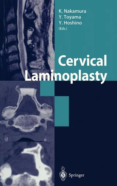 Cervical Laminoplasty - Hardcover