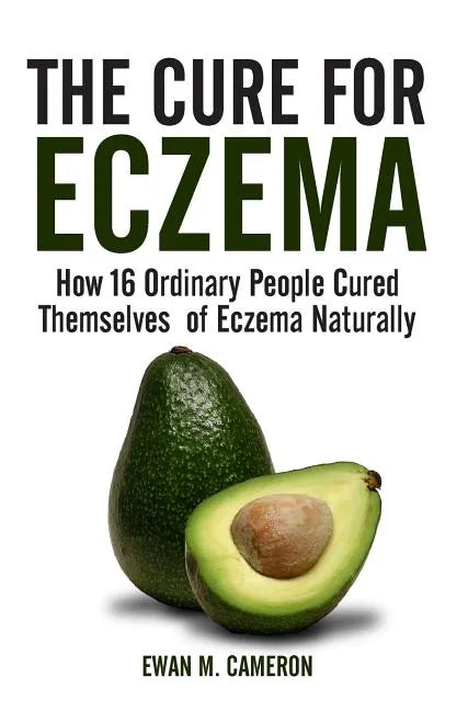 The Cure for Eczema - Hardcover