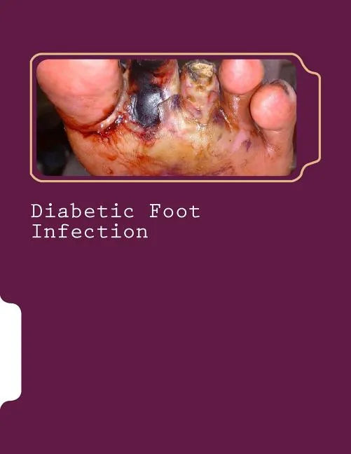 Diabetic Foot Infection - Paperback
