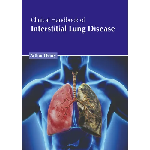 Clinical Handbook of Interstitial Lung Disease - Hardcover