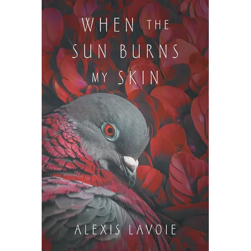When the Sun Burns My Skin - Paperback