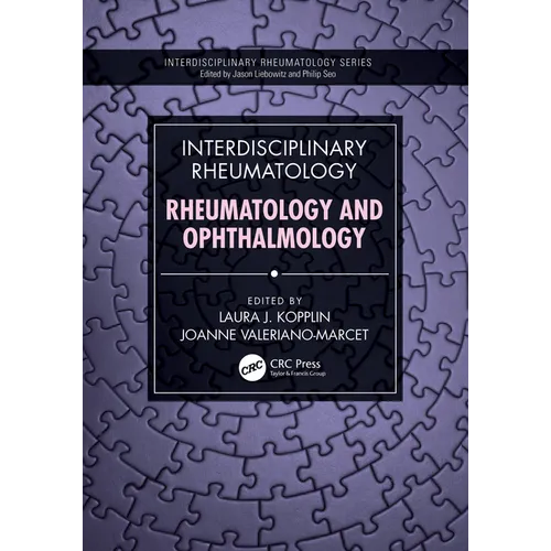 Interdisciplinary Rheumatology: Rheumatology and Ophthalmology - Paperback