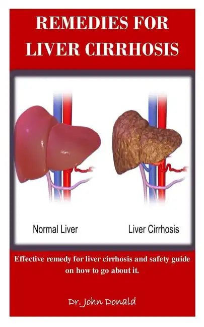 Remedies For Liver Cirrhosis: Effective remedies for liver cirrhosis and safety guide on how to go about it - Paperback