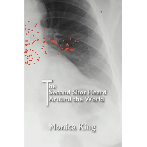 The Second Shot Heard Around the World - Paperback