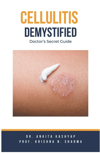 Cellulitis Demystified: Doctor's Secret Guide - Paperback