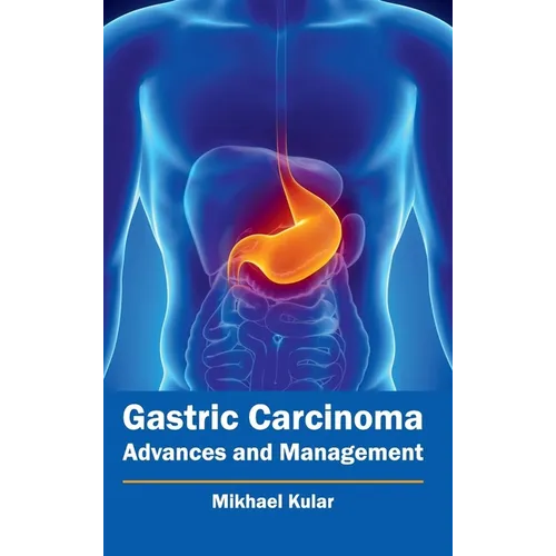 Gastric Carcinoma: Advances and Management - Hardcover