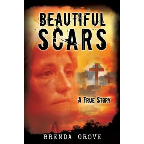 Beautiful Scars - Paperback