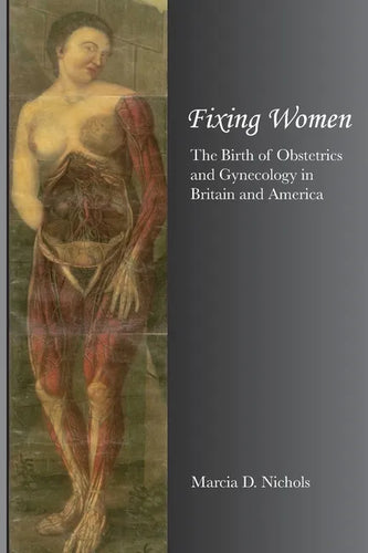 Fixing Women - Paperback