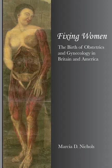 Fixing Women - Paperback