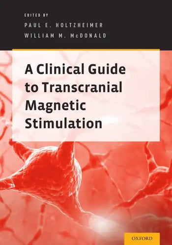 Clinical Guide to Transcranial Magnetic Stimulation - Paperback