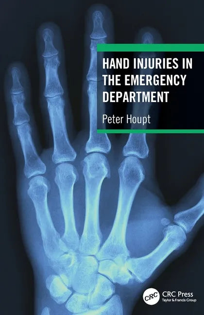 Hand Injuries in the Emergency Department - Paperback