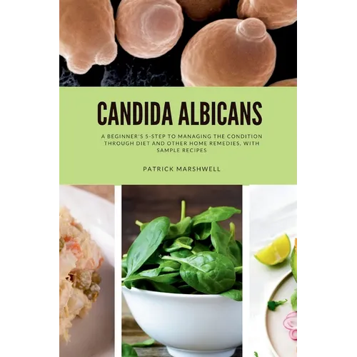 Candida Albicans: A Beginner's 5-Step to Managing the Condition Through Diet and Other Home Remedies, With Sample Recipes - Paperback