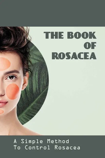 The Book Of Rosacea- A Simple Method To Control Rosacea: Rosacea Treatment For Face - Paperback
