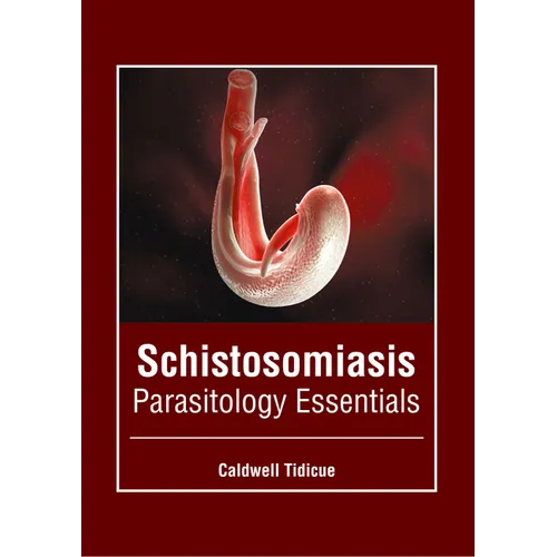Schistosomiasis: Parasitology Essentials - Hardcover