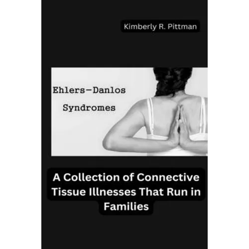 Ehlers-Danlos Syndrome: A Collection of Connective Tissue Illnesses That Run in Families - Paperback