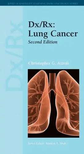 DX/Rx: Lung Cancer: Lung Cancer - Paperback