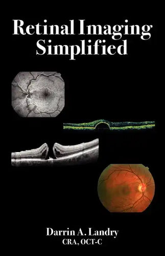 Retinal Imaging Simplified - Paperback