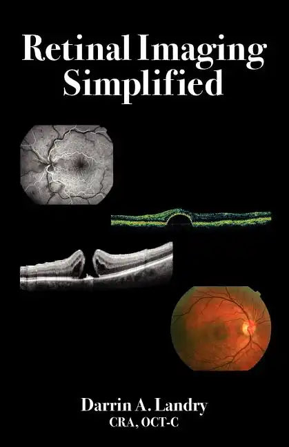 Retinal Imaging Simplified - Paperback