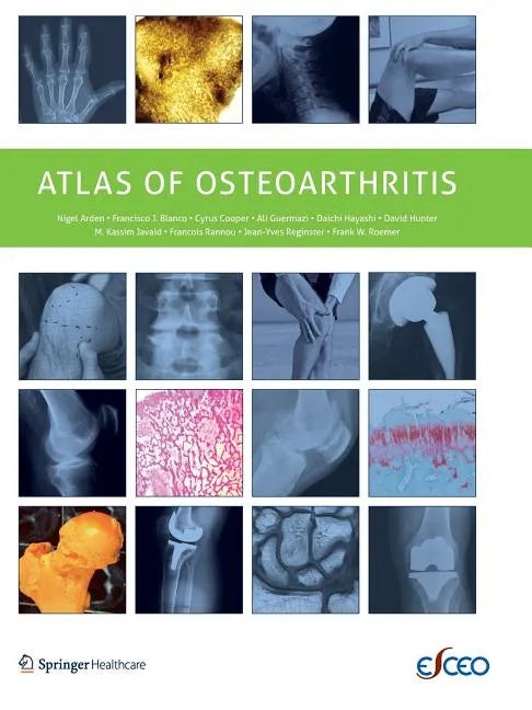 Atlas of Osteoarthritis - Paperback