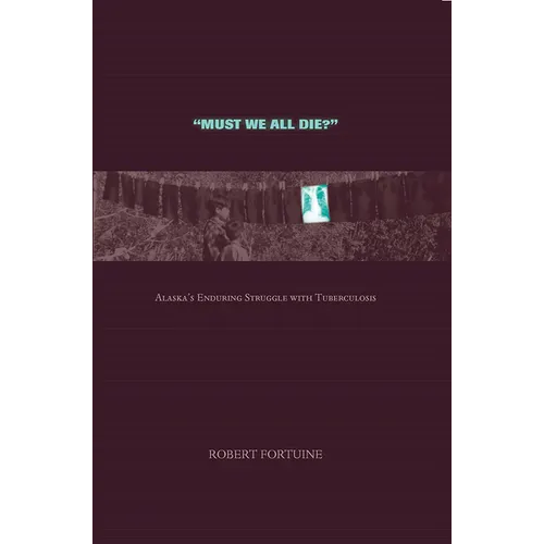Must We All Die?: Alaska's Enduring Struggle with Tuberculosis - Paperback