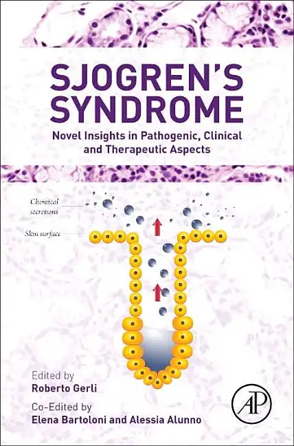 Sjogren's Syndrome: Novel Insights in Pathogenic, Clinical and Therapeutic Aspects - Hardcover