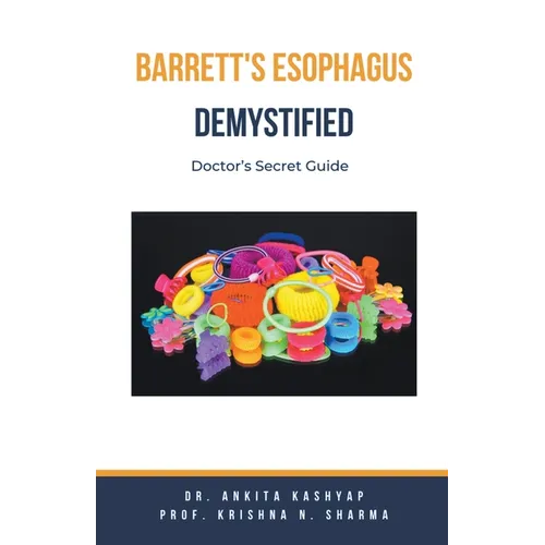 Barretts Esophagus Demystified: Doctor's Secret Guide - Paperback