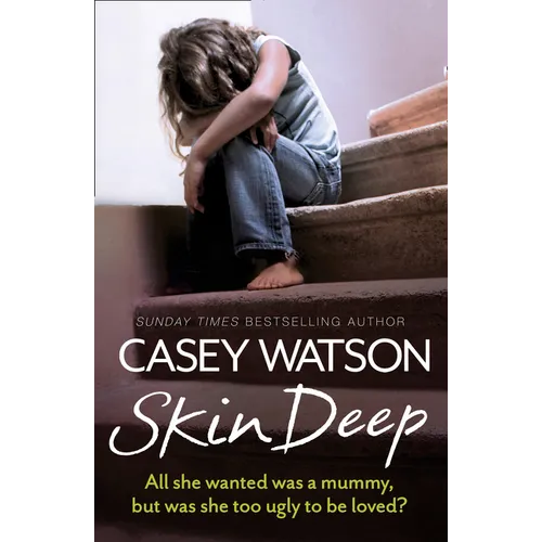 Skin Deep: All she wanted was a mummy, but was she too ugly to be loved? - Paperback