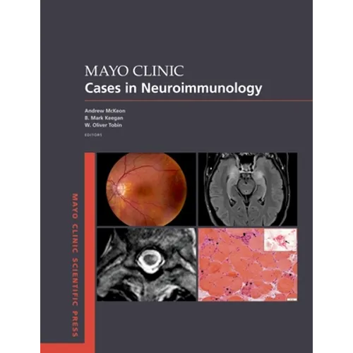 Mayo Clinic Cases in Neuroimmunology - Paperback