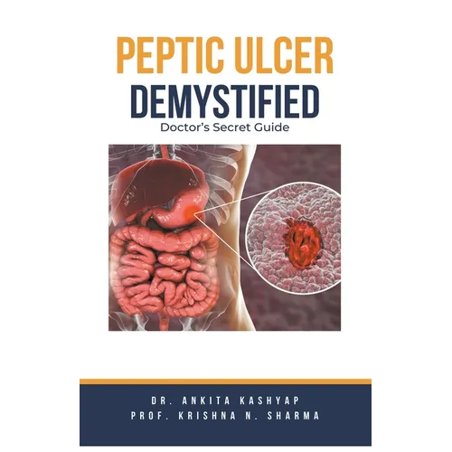 Peptic Ulcer Demystified: Doctor's Secret Guide - Paperback