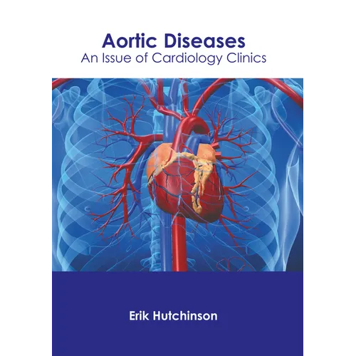 Aortic Diseases: An Issue of Cardiology Clinics - Hardcover
