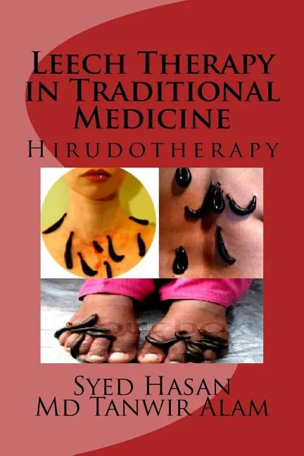 Leech Therapy in Traditional Medicine: Hirudotherapy - Paperback
