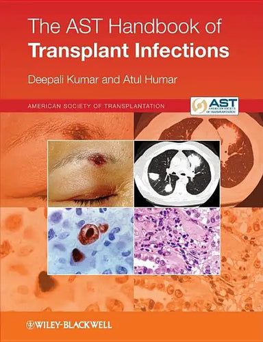 The Ast Handbook of Transplant Infections - Paperback