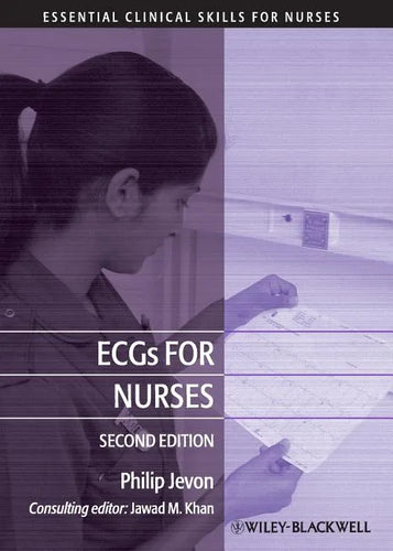 Ecgs for Nurses - Paperback
