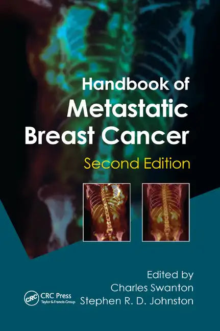 Handbook of Metastatic Breast Cancer - Paperback