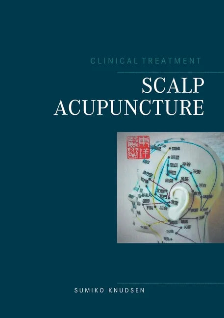 Scalp Acupuncture - Paperback