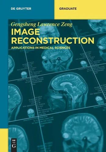 Image Reconstruction: Applications in Medical Sciences - Paperback