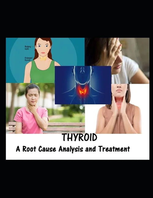 Thyroid: A Root Cause Analysis and Treatment - Paperback