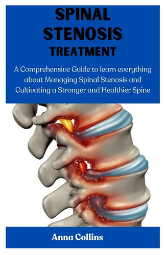 Spinal Stenosis Treatment: A Comprehensive Guide to learn everything about Managing Spinal Stenosis and Cultivating a Stronger and Healthier Spin - Paperback