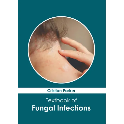 Textbook of Fungal Infections - Hardcover