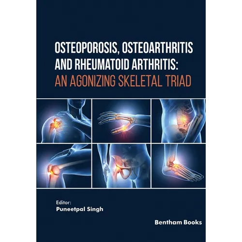 Osteoporosis, Osteoarthritis and Rheumatoid Arthritis: An Agonizing Skeletal Triad - Paperback