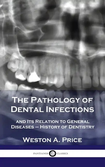 Pathology of Dental Infections: and Its Relation to General Diseases - History of Dentistry - Hardcover