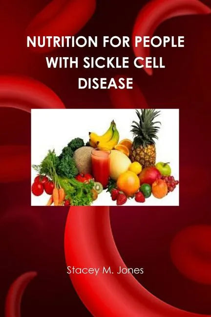 Nutrition for people with Sickle Cell Disease - Paperback
